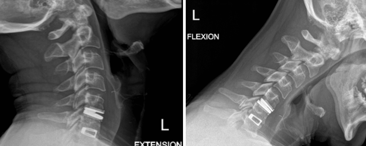 figure2